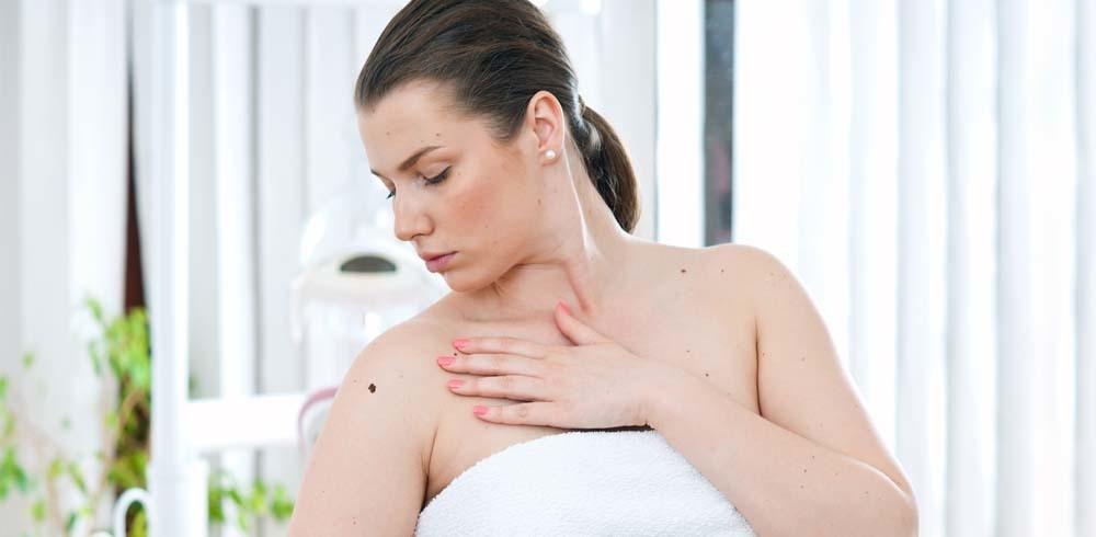 Self Examination For Melanoma