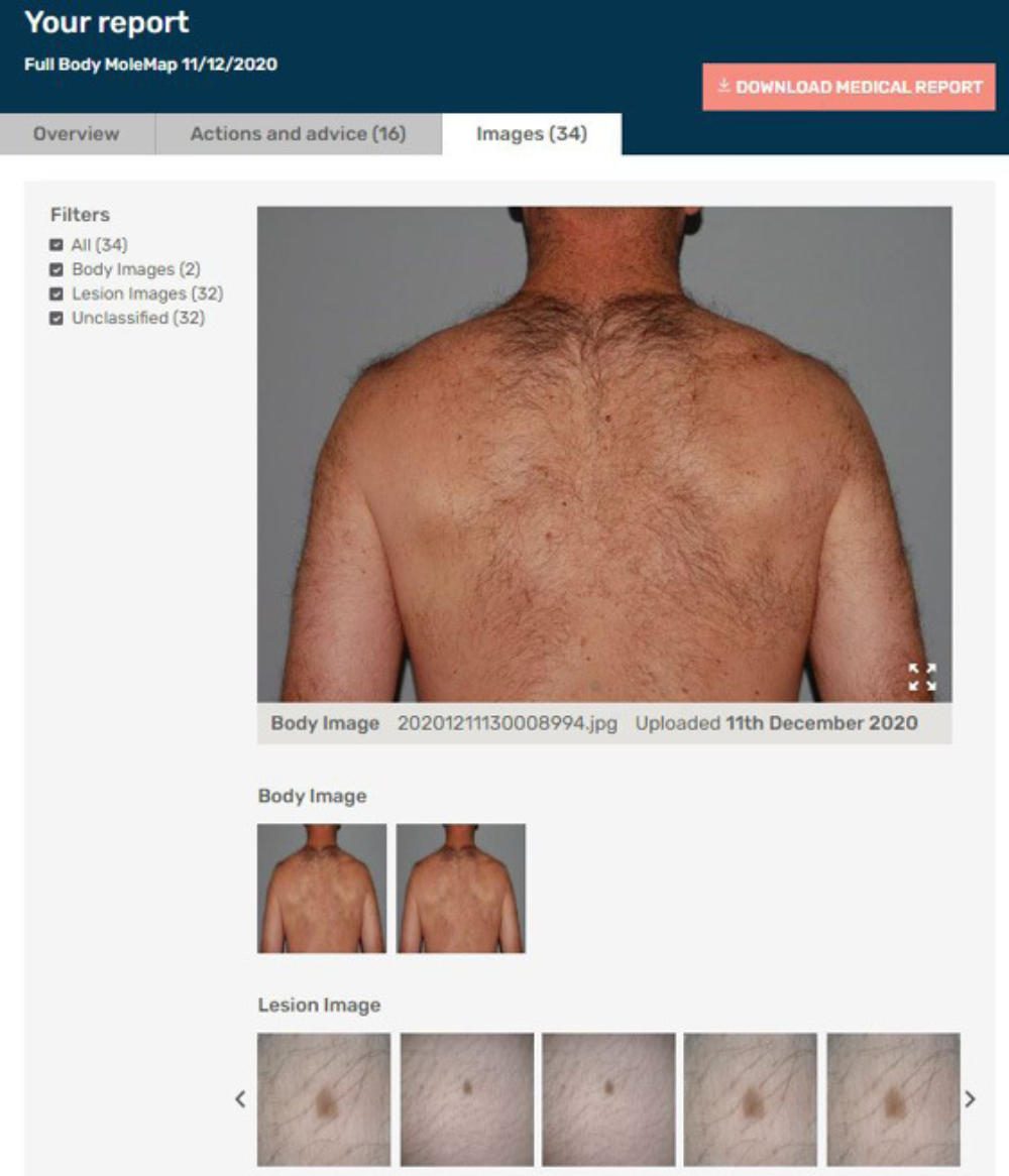 molemapwebsite MoleMap Australia