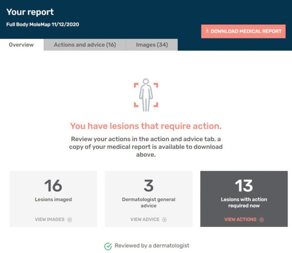 molemapwebsite MoleMap NZ Official Site