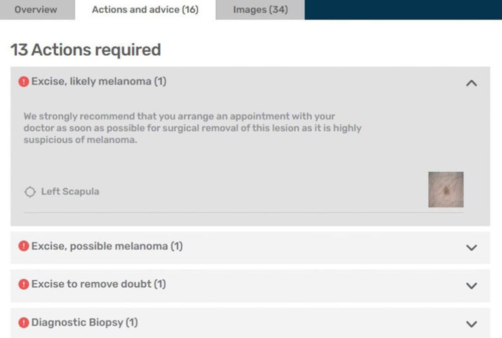 molemapwebsite MoleMap Australia